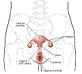 cesium vaginal Intracavitary insertions